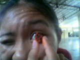 Kiamoy Eye